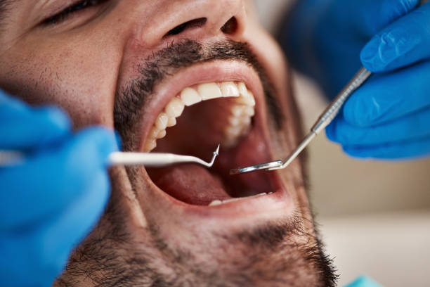 Best Dentist for Tooth Abscess  in Centralia, WA