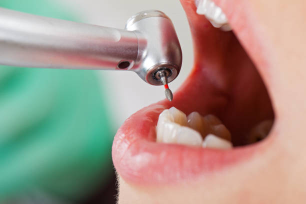 Best Cracked Tooth Emergency Dentist  in Centralia, WA